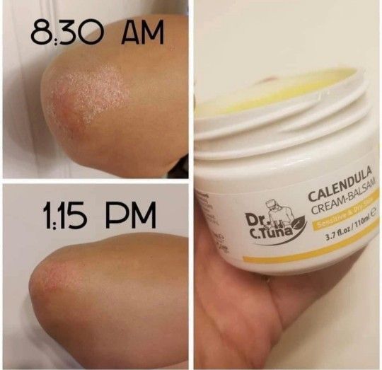 Crema De Calendula