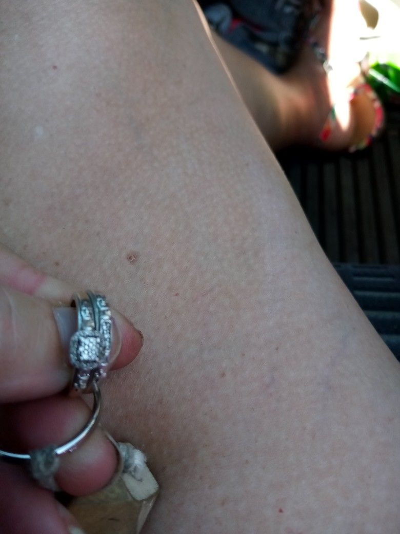 Rings Wedding Set