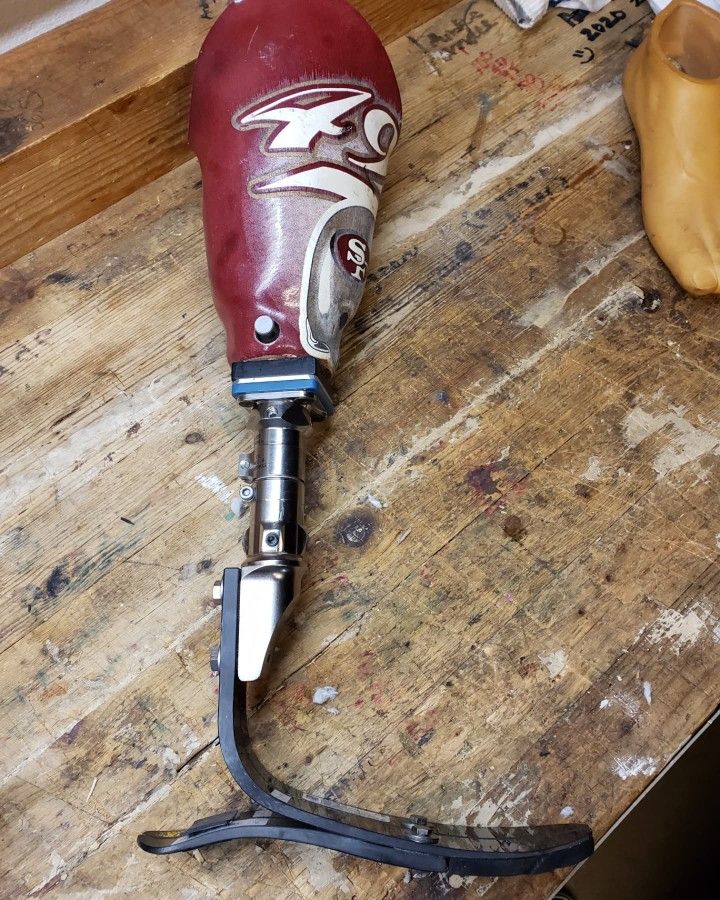 Rare Timed Prosthetic Leg Excellent Condition With Mint Variflex Foot